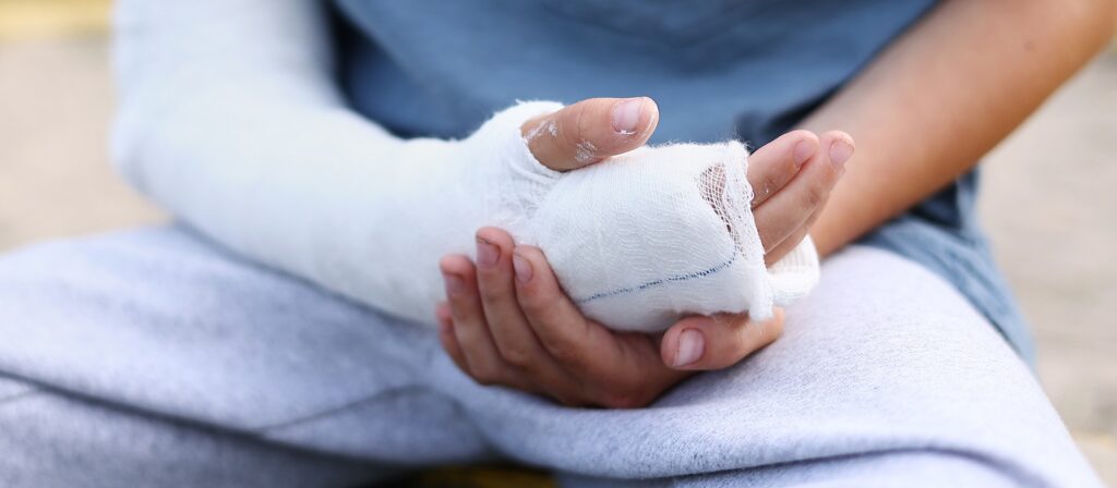 A person wearing light gray sweatpants and a blue shirt sits with their left forearm in a white plaster cast, holding the injured arm gently with their right hand.